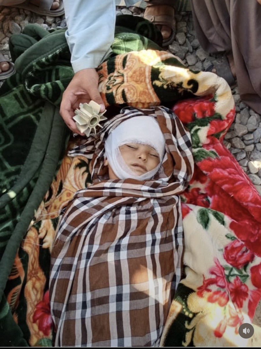 Ilyas_baloch01's tweet photo. Another innocent child’s smile has been silenced. How long will the innocent children of #Balochistan continue to be drenched in blood? 
#Mustung #JusticeForBalochistan #StopKillingCivilians #StopBalochGenocide #releasbalochmesingpersons https://t.co/R35ESlYi6E