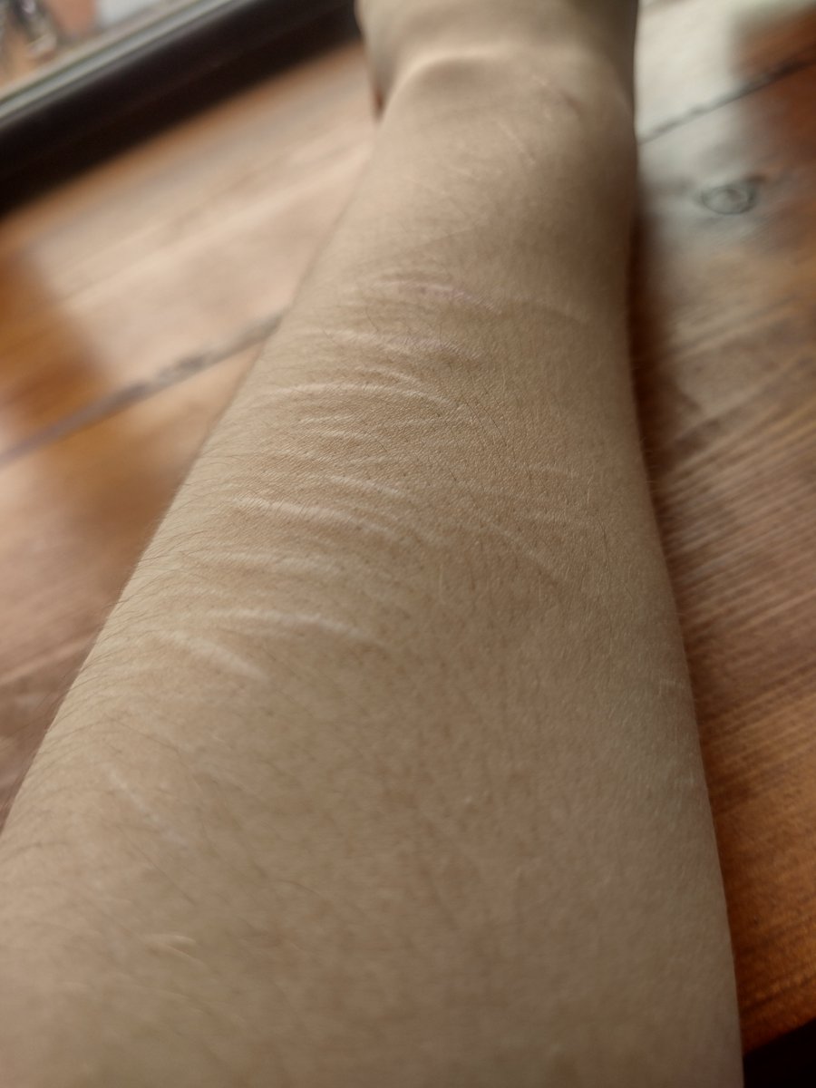 lightningkevin0's tweet photo. healed and there are barely any there anyway ☹️
 
sfx drawn on stage makeup https://t.co/3wVdG1KuhI