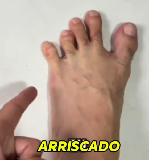 Alg0v4's tweet photo. @ZanfaVive Eta pezinho feio da poha https://t.co/XR8A82ZGoO