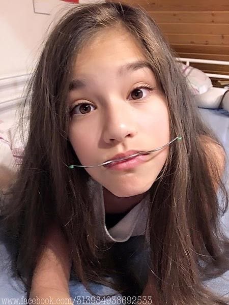rintarded0k's tweet photo. Something about 80s style braces 🥴 https://t.co/hgsJK81JyS