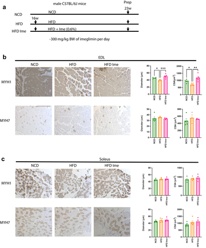 agingdoc1's tweet photo. Imeglimin Attenuates Skeletal Muscle Atrophy in Mouse Models of Obesity and Ageing

https://t.co/ug2ubCOMqh https://t.co/qKEWVP6n4Y