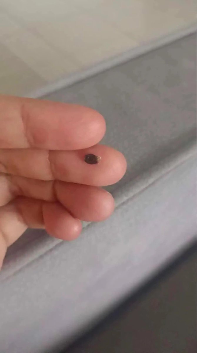 Thanaphol098's tweet photo. "เพื่อนที่ออฟฟิศป้ายยา WART REMOVAL มาให้ลองเป็นติ้งเนื้อที่นิ้ว 

ตอนแรกก็แอบคิดว่าจกตาป่าววะ 😭 สรุปคือติ่งเนื้อหลุดออกมาจริงๆ แก!! แค่แต้มทิ้งไว้ รอให้มันแห้ง หดเล็กลง แล้วหลุดออกเองเลย ชีวิตดีขึ้นมาก￼ https://t.co/owRixqYHkf
