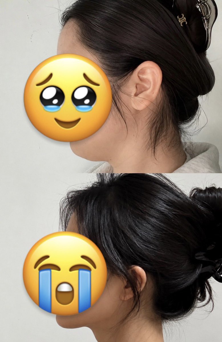 Kawaiiikamo's tweet photo. これ即効性ヤバい……ストレートネックすぎて恐竜？？ってレベルだったんだけど、2週間でここまで変わった😭 https://t.co/H3DperWvbm
