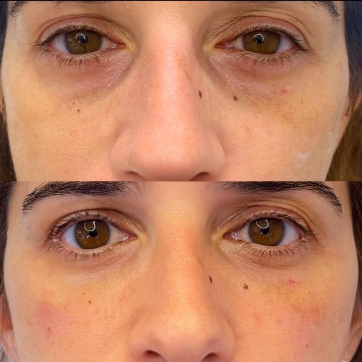 artzsdeco's tweet photo. Opinião impopular: o creme para olhos Eucerin é simplesmente o melhor que existe para clarear mais as olheiras e eu falo sem medo de errar https://t.co/PxMNUWdXNw