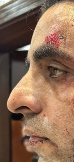 ARYSabirShakir's tweet photo. اسلام آباد میں جرنلسٹ احتشام عباسی پر حملہ قابل مذمت ہے https://t.co/HQaaZOvuqd