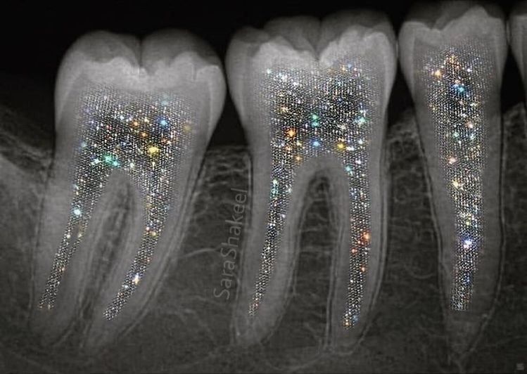 latestincosmos's tweet photo. 🚨: Japan trials new drug that regrows human teeth ─ ending dentures and implants forever. https://t.co/puMWgWRdOI