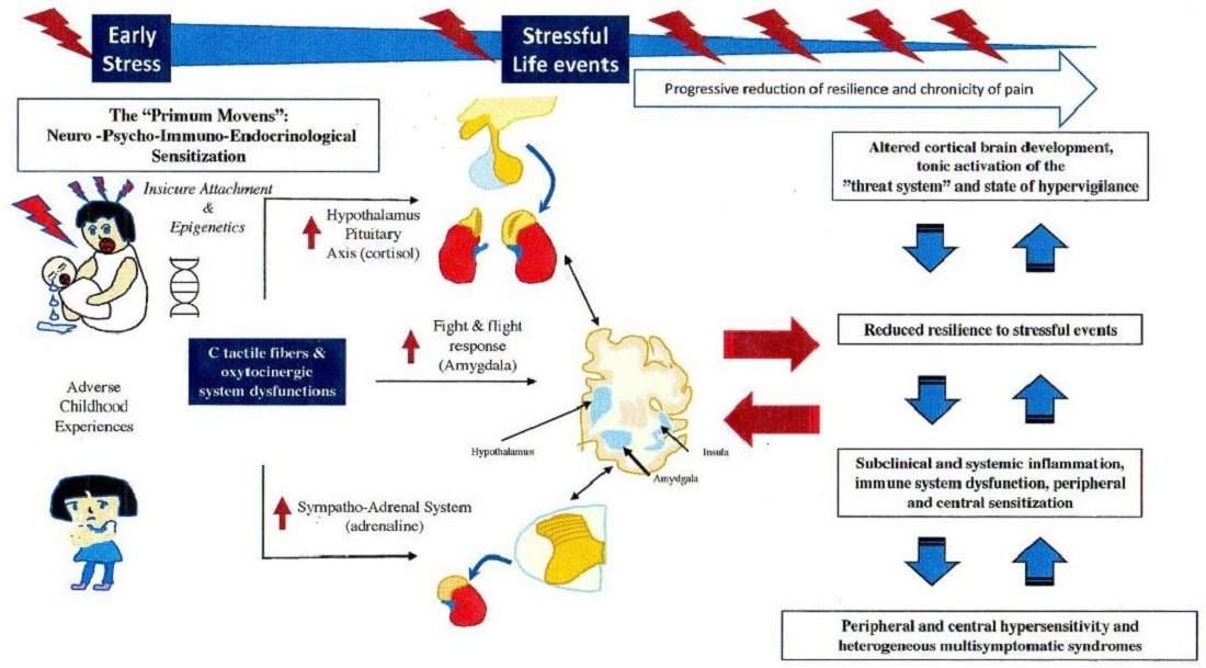 Biomed_MDPI's tweet photo. 🧠 The mechanisms underlying fibromyalgia remain complex. This article examines potential links between stress response, attachment, C-tactile fibers, and oxytocinergic system dysfunction within a biopsychosocial model. #Fibromyalgia #PainResearch
https://t.co/bjJs0BWQ2w https://t.co/5iS7vQE83t