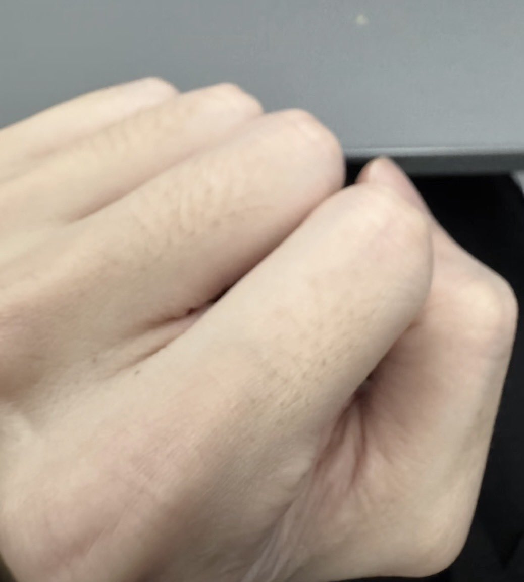 Ottoboke_'s tweet photo. ほんとだ。指の毛穴ってガチで消えるんだ、、、 https://t.co/5yiZFfjdtu