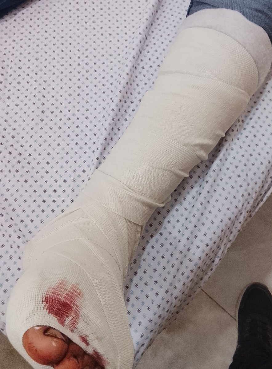dymd386258's tweet photo. https://t.co/gbD7pdPR3r
Ey Türkiye'nin yüce insanları… Ey Cumhurbaşkanı Recep Tayyip Erdoğan, Allah sizi korusun ve muhafaza etsin…

Gözlerimden yaşlar süzülerek size yazan, yıkılmış bir babayım.

Oğlum… sevgili evladım… Nuseirat'ta bir cenaze alayı bombalandığında ağır yaralandı. Yolda yürüyorduk ki birdenbire dünya altüst oldu. Yarası uzun ve derin, cerrahi dikişlerle ve drenaj tüpüyle dolu. Her gün acı çekiyor ve ilaç alıyor.

Eşim de yaralandı… ve evimiz küçük bir hastaneye dönüştü. Yaralanmalarına ve güçsüzlüklerine uygun ilaçlara, ağrı kesicilere, vitaminlere ve özel yiyeceklere ihtiyacımız var ve masraflar bizi her geçen gün daha da yıpratıyor.

Allah'tan ve sizin cömertliğinizden başka kimsem kalmadı.

Ey Türkler… Ey şeref ve şövalyelik sahibi insanlar… Ey her zaman ezilenlerin yanında olanlar… lütfen bana yardım edin ki oğluma ve eşime hayatta kalmaları için gereken tedaviyi ve yiyeceği sağlayabileyim.

Sayın Cumhurbaşkanım Erdoğan… Siz, doğru olanın yanında durmanın sembolüsünüz ve Türkiye'nin kapılarını ihtiyaç sahiplerine açan kişisiniz… Sizden, cömert halkınızdan rica ediyorum, beni görün ve oğlu için ölümle mücadele eden bir babanın sesini duyun.

Ne kadar küçük olursa olsun, her türlü yardım bizim için hayat demektir.

Allah sizi mükafatlandırsın ve Türkiye'yi, halkını ve cumhurbaşkanını korusun.

Gazze'de yüreği kanayan bir babadan.