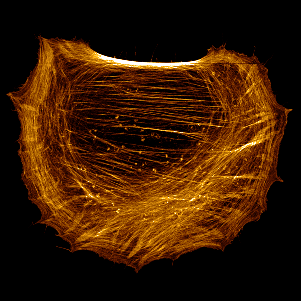 _Viroscope's tweet photo. Actin in a fibroblast for #MicroscopyMonday.

What type of actin structure is your favourite? :)

🔬 : Joe McKellar, Viroscope Imaging https://t.co/UFdi3KcaUl