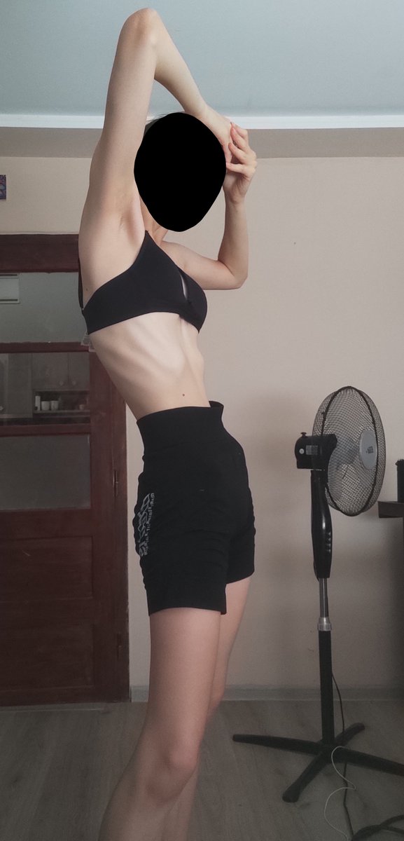 635kcals's tweet photo. this is either bmi 15.4 or bmi 15.0 cause i dont know my height what do yall think https://t.co/rRszwb8A8O