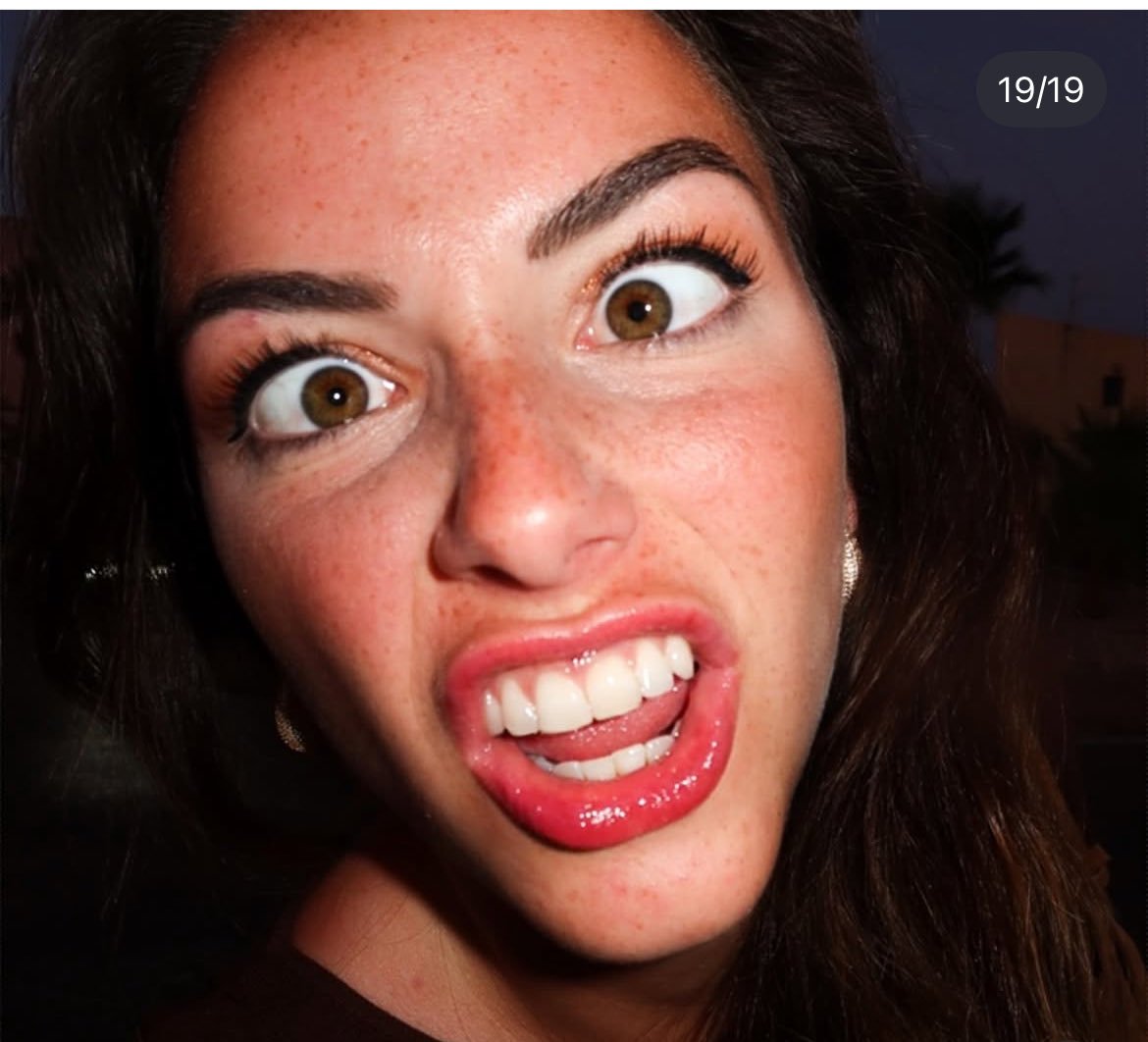 jwillywally's tweet photo. I never want to get better 😵‍💫
#faceporn #celeb #goon #cringe #face #mouth #loser https://t.co/nhjZtfGpbu