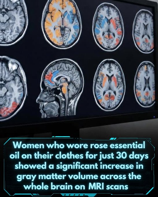 Rainmaker1973's tweet photo. A recent study has demonstrated that continuous exposure to rose essential oil through inhalation can lead to measurable increases in gray matter volume in the human brain.

In this randomized controlled intervention, 50 healthy women participated: 28 in the experimental group applied rose essential oil to their clothing daily for one month, while 22 in the control group used plain water. Before and after the period, researchers used magnetic resonance imaging (MRI) to assess changes in brain structure. The results indicated a significant increase in gray matter volume (GMV) across the whole brain, with a particularly notable effect in the posterior cingulate cortex (PCC)—a region involved in memory processing, self-referential thinking, and emotional regulation. No significant changes occurred in areas like the amygdala or orbitofrontal cortex.

The olfactory pathway likely explains this effect: aromatic compounds from the rose oil travel directly to the limbic system, providing sustained stimulation that may promote neuroplasticity and help counteract age-related brain atrophy. The authors suggest this could have implications for dementia prevention, as the PCC is among the regions affected early in conditions like Alzheimer's disease.

This appears to be the first evidence that prolonged scent inhalation can induce structural changes in the adult human brain.

[Kokubun, K., et al. (2024). Continuous inhalation of essential oil increases gray matter volume. Brain Research Bulletin, 208, 110896. DOI: 10.1016/j.brainresbull.2024.110896]