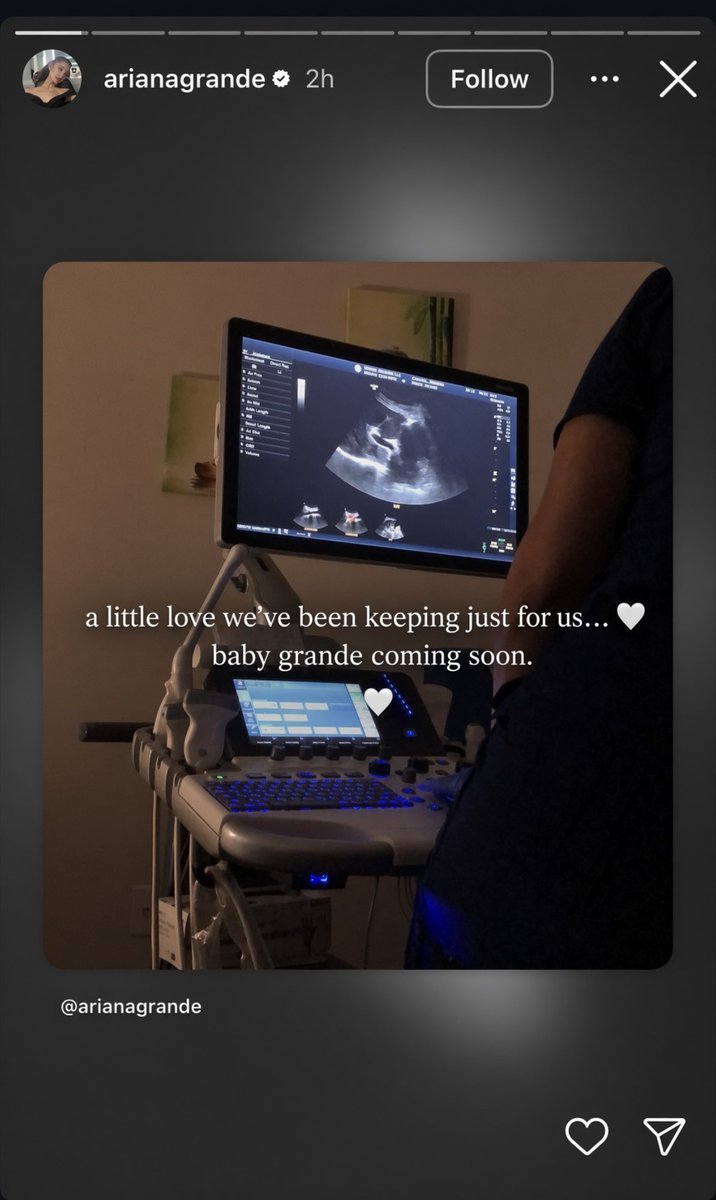 justmercy__'s tweet photo. Ariana Grande has taken to her Instagram Story to announce to her fans that she and her boyfriend, Ricky Alvarez, are expecting a baby. 🥹❤️

“a little love we’ve been keeping just for us… 🤍 baby Grande coming soon. ♡” she wrote. https://t.co/nbnSWlJLRs
