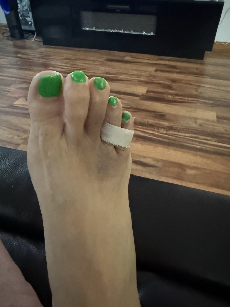 GoddessBri48's tweet photo. Who wants to see my black and purple foot really attractive isn’t it at least it’s not broken and the swelling going down so who’s gonna cover my medical bills cause your Goddess had to go to the doctor https://t.co/7woCVirSoC