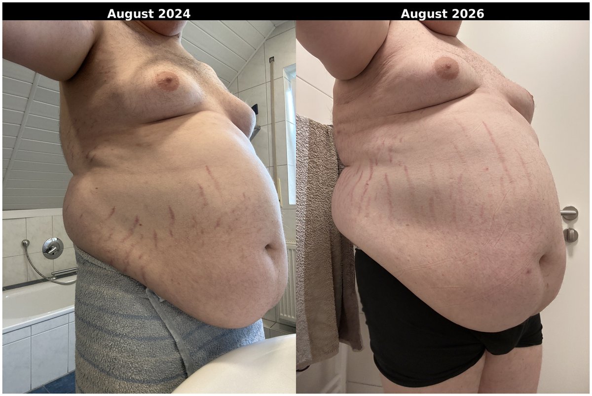 Youngfat2003's tweet photo. 2024 war schon viel.
2026 ist noch mehr.
Und trotzdem will ich weiter zunehmen
Dicker. Runder. Schwerer.
Wie findet ihr das?

#bodypositivity #plussize #gaining #belly #weightgain https://t.co/RI6jsrwS87