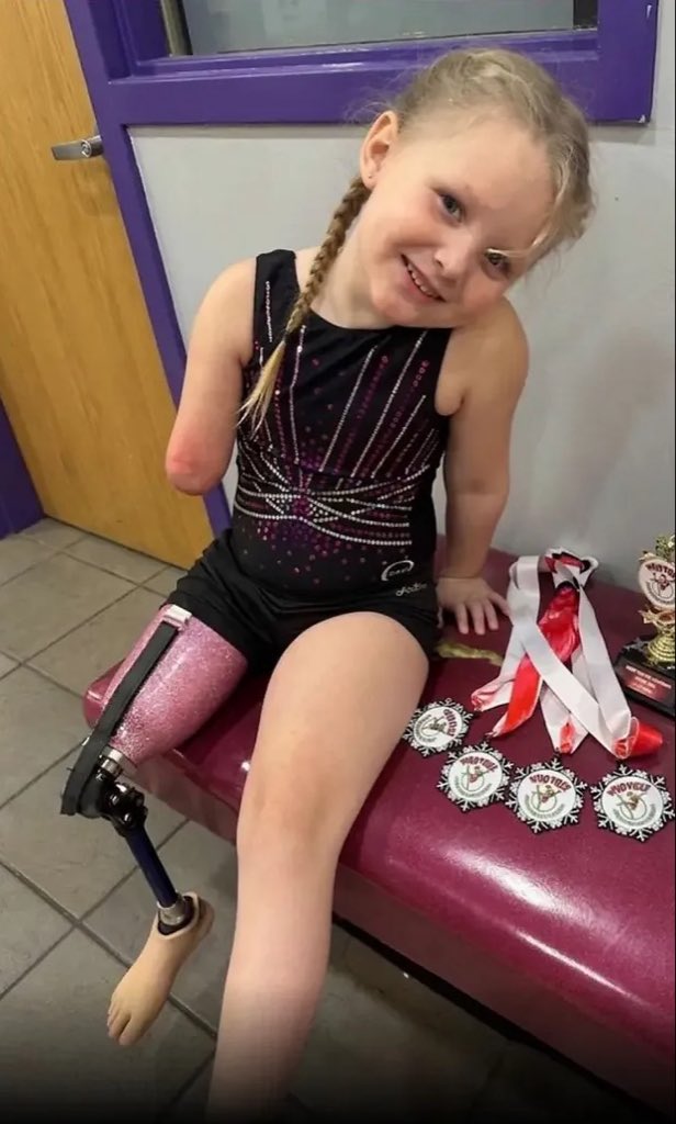 Averysurge's tweet photo. A 6 year old girl triple amputee made history by completing in state level gymnastics. 

she proves that nothing is impossible 🥹❤️ https://t.co/nnDRazBHyX