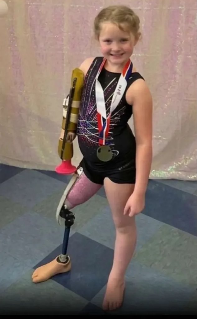 Averysurge's tweet photo. A 6 year old girl triple amputee made history by completing in state level gymnastics. 

she proves that nothing is impossible 🥹❤️ https://t.co/nnDRazBHyX