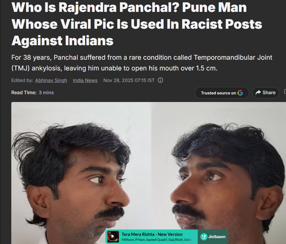 GeyAllla's tweet photo. @NaitraNepal @TexanBridger Tit for tat ,the guy you made the meme about was also a TMJ patient, which is why his mouth couldn’t open. https://t.co/5Hbg3W7ERw