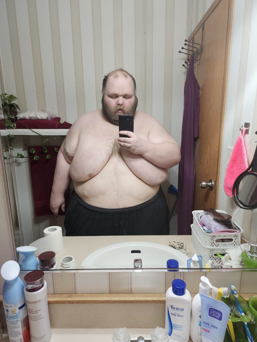 Carnivorecure's tweet photo. 🥩 DAY 1,339 CARNIVORE 🥩
372 POUNDS DOWN.
On January 1st, 2023, I made a decision that changed the trajectory of my life.
1,339 days later:
✅ 372 lbs lost
✅ Congestive heart failure — resolved
✅ Complications from my stroke — resolved
✅ 6 liters of supplemental oxygen — OFF OXYGEN
✅ Depression with suicidal ideation — resolved
✅ Crippling anxiety — resolved
✅ COVID lung complications — resolved
✅ Long COVID — resolved
✅ Reactive airway disease — resolved
✅ Sleep apnea — resolved
✅ Prediabetes & insulin resistance — resolved
✅ Metabolic disease — resolved
✅ Lymphedema symptoms — ~90% improved
✅ Gout — resolved
✅ Resting tachycardia — resolved
✅ Eating disorder — resolved
I didn't start carnivore because I wanted abs.
I started because I wanted my life back.
I still have work to do. I'm still healing, still losing weight, still getting stronger, and still moving forward.
But after 1,339 consecutive days of carnivore, I can look back at where I started and say:
I'm not the same man who started this journey.
372 pounds gone. A life reclaimed. And I'm not finished yet.
🥩 Day 1,339. Keep going.
#Carnivore #CarnivoreDiet #CarnivoreTransformation #WeightLossJourney #372PoundsDown #MetabolicHealth #Transformation #TheCarnivoreCure #KeepGoing
