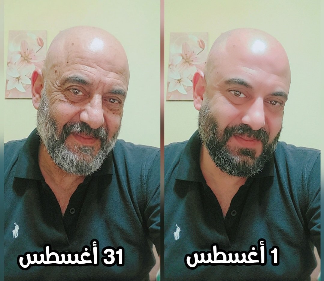 _FiZo_'s tweet photo. 👩‍🦲👴 https://t.co/zgX4XhNwvK