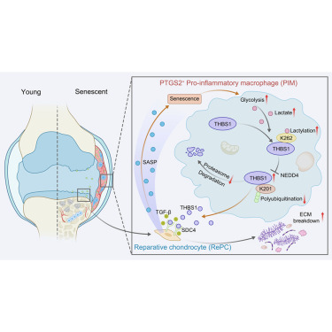 AgingBiology's tweet photo. Targeting pro-senescent PTGS2+ macrophages alleviates chondrocyte senescence and osteoarthritis progression
https://t.co/yk4eiAEkDH https://t.co/Y1GxmGzSmB