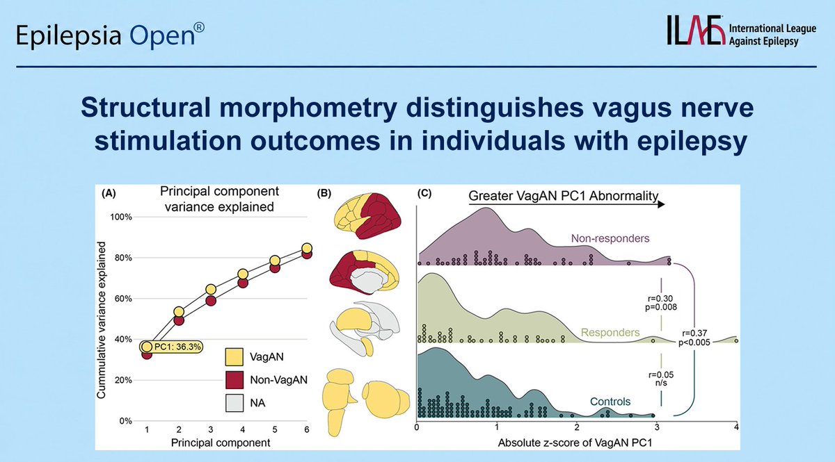 EpilepsiaOpen's tweet photo. Non-responders to #VNS for epilepsy show more structural abnormalities in their vagus afferent network compared to responders and controls. This suggests pre-implant T1w MRI could help predict VNS outcomes.
https://t.co/ZHbypMXA8S
#epilepsy #ILAE #epilepsiaopen #drugresistant https://t.co/q6NIuItNhH