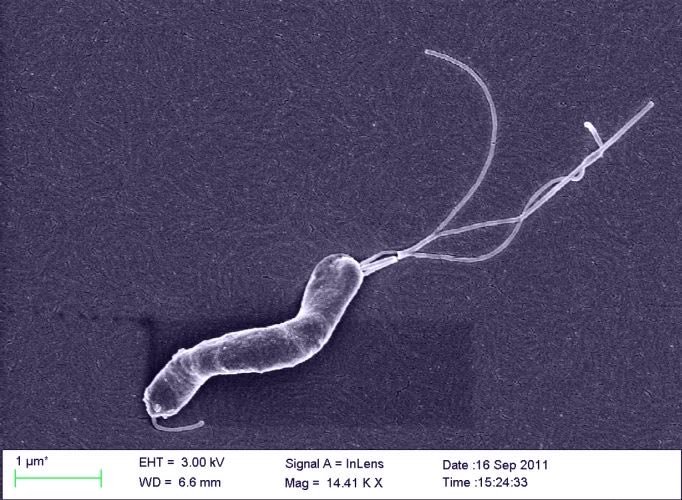 FarvingCo's tweet photo. A doctor said “f*ck it” and DRANK H. PYLORI in 1984 to prove it causes stomach ulcers.

NOBODY believed him. He was sick WITHIN DAYS. He won the Nobel Prize.

53% of you carry the same bacteria. It’s in your stomach while you read this:

• bloating after meals that should be fine
• acid reflux (it’s actually LOW acid, not high)
• belly fat that won’t respond to deficit
• thinning hair and eyebrows
• fatigue even with 8 hours of sleep
• supplements that do nothing no matter what you take

If you checked 3 or more - it might not be aging. It might be H. pylori.

Here’s the exact stack I used to kill it: 🧵