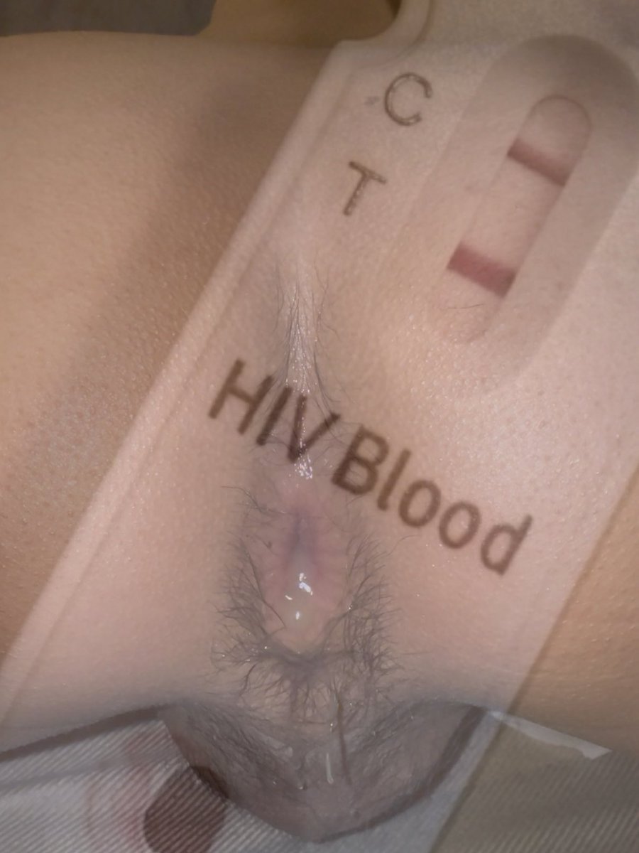 xinnnnnnnnnnn0's tweet photo. 学长说我的艾滋尖逼���起来很爽😋
#poz #hiv #hpv #艾滋 #尖锐 #毒交 #追毒 #男大 #恶堕 https://t.co/sQplf8D4FA