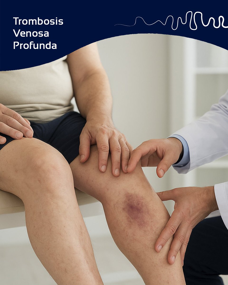 MedicVascular's tweet photo. La trombosis venosa profunda ocurre cuando un coágulo de sangre bloquea una vena en las piernas, lo que puede ser peligroso si no se trata.🚑

Envía un mensaje directo y resuelve tus dudas con nuestros especialistas.

#Trombosis #SaludVascular #Prevención https://t.co/oHm1Ip4JLE