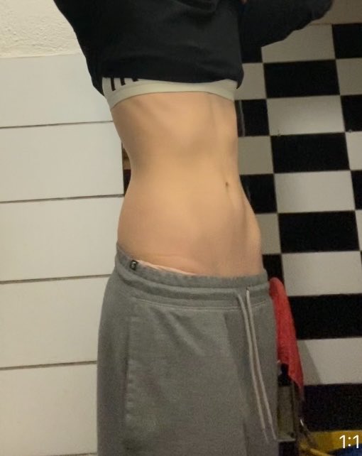 anikcal's tweet photo. ok nvm i miss her i miss being skinny and miserable😭

this was after throwing my guts up AT WORK lmao https://t.co/RA3nzrteZG
