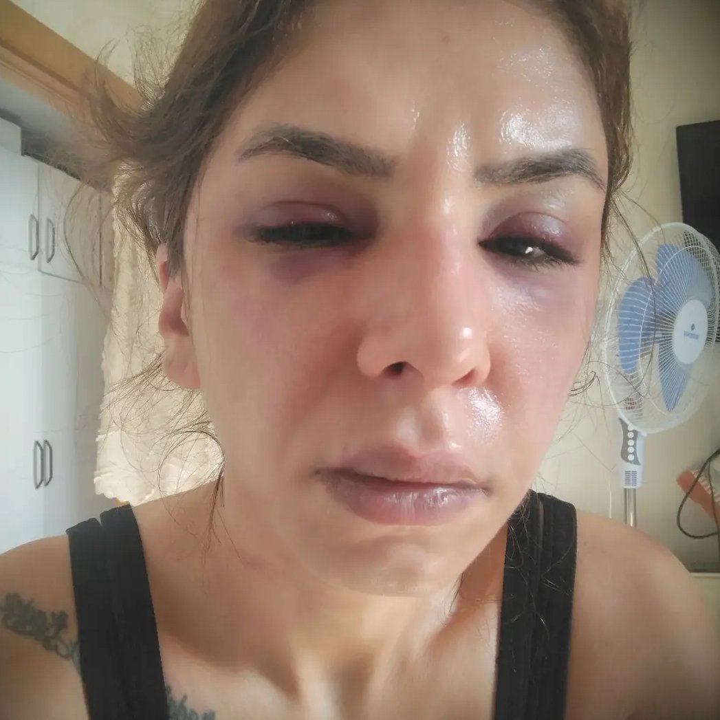 meneymn's tweet photo. BENİ SARJ KABLOSU İLE BOĞDU, PARA CEZASI İLE SERBEST BIRAKILDI!

4 yıl boyunca o evde çocuklarımla ölümü bekledim, kemerle, sarj kablosuyla işkence gördüm. kaçmasam bugün ben de bir cinayet haberi olacaktım. Sadece YAŞAMAK İSTİYORUM.. Lütfen Sesimi Duyun.. 
@adalet_bakanlik https://t.co/IuxKKKLnGp