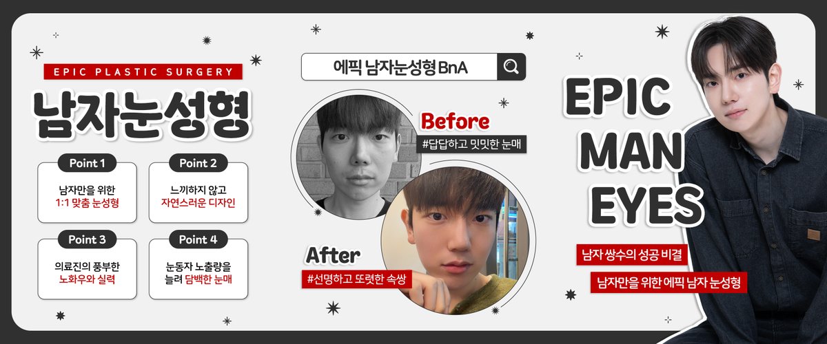 epic_plastic's tweet photo. ⠀
남자 쌍수의 성공 비결,
남자만을 위한 에픽 남자 눈성형❤️
.
.
#에픽성형외과 #에픽 #신사성형외과 #신사역성형외과 #성형외과추천 #노용준 #노용준원장 #홍진명 #홍진명원장 #성형외과전문의 #눈성형 #눈재수술 #쌍꺼풀수술 #쌍수 #남자성형 #남자눈성형 #남자쌍수 https://t.co/YjjmVJeKZb
