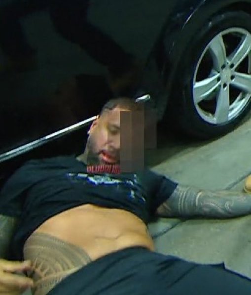 WrestleOps's tweet photo. Netflix blurred out a bloody Jey Uso.

#WWERAW https://t.co/GtoKNuNCxz