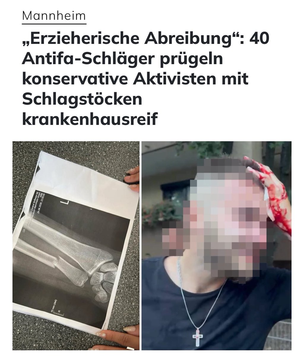 frei_geist_'s tweet photo. Wann kommt endlich das Verbot der #Antifa? https://t.co/LIWlR6vtf2