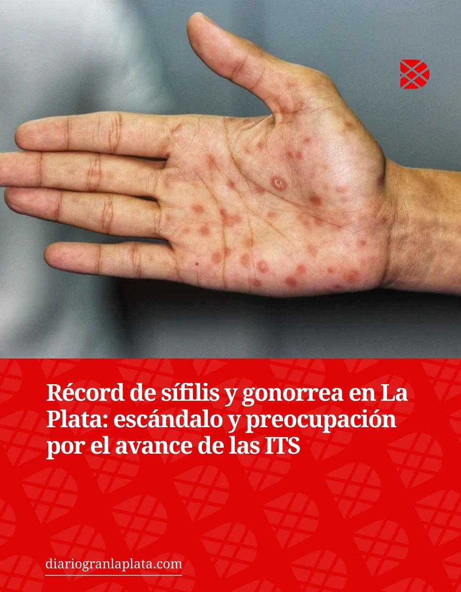 V18967888's tweet photo. Tranqui La Plata peronista ✌🏼
Gracias Kicillof y Alak por convertir a la ciudad en un pozo de mierda.
Tomas de tierra, inseguridad , mugre y pestes. https://t.co/8HZw0mtdpD