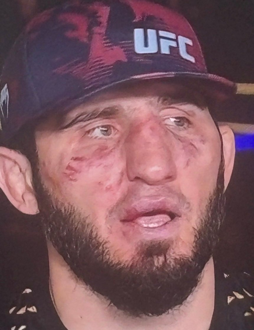StephanosI49472's tweet photo. @aakia__ @WalnutMMA This is his face after gay cuck Ian garry fought him.Anf you know what he did absolutely nothing but humping him and crotch sniffing for 25 min absolute bum.And don't forget islam slept like a baby by pantoja https://t.co/AmYvOQ4ViT