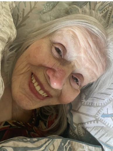 skymeds_store's tweet photo. I just had to share this. 🙌
My mom had this nasty spot on her nose. Skin cancer (SBCC). It kept getting worse.

They gave her Aldara cream – $120 out of our pocket. It barely helped.

I called my sister – she had Ivermectin cream prescribed for my nephew. She sent it to me.

Day 1:
I put it on her nose myself. The nursing home staff looked at me sideways. I didn't care.

Day 2:
I went back the next morning and couldn't believe my eyes.

The redness had already calmed down. The crusty spot was shrinking. It was like night and day.

I took a picture. Compared it to the day before. I almost cried.

Day 5:
Completely gone.

Just like that. A $250 tube of Ivermectin cream did what the $650 prescription couldn't.

Her nose is smooth. Clear. Like nothing was ever there.

Mom's doctor?
He was impressed. Couldn't believe it. He actually ordered a tube for the nurses to use if any other lesions pop up.

Ivermectin isn't just for parasites.
It's for skin cancer. For rosacea. For stubborn fungal infections. For all kinds of things the system won't tell you about.

Liquid. Paste. Pills. They all have their place.

I'm so grateful my mom is close by.
I can go in, monitor her, and be her advocate.

Some doctors don't recognize Ivermectin for skin cancer. But I knew it was worth a shot.

And here we are.

Praise The Lord. 🙏