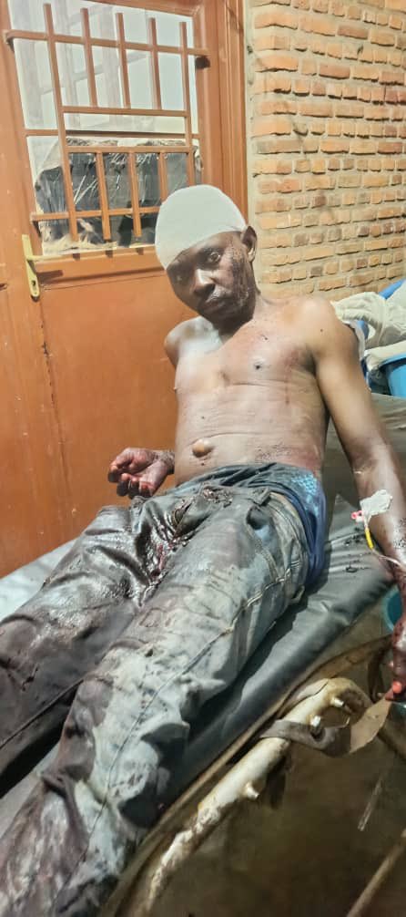 LawrenceKanyuka's tweet photo. MISE À JOUR SUR LA GUERRE IMPOSÉE PAR LE RÉGIME DE KINSHASA
1er SEPTEMBRE 2026

Le refus délibéré et persistant du régime de Kinshasa de neutraliser les FDLR constitue l’un des principaux facteurs d’aggravation de l’insécurité et de la détérioration continue de la situation sécuritaire, aussi bien sur les lignes de front que dans les zones civiles densément peuplées.

Dans la nuit du lundi 31 août 2026, vers 21h45, des éléments des FDLR ont mené une attaque contre des populations civiles dans la localité de Mulala, située à environ 20 km de Vitsumbi, dans le territoire de Rutshuru. Cette attaque a fait 4 morts et 10 blessés parmi les civils, tandis que 2 femmes ont été enlevées alors qu’elles travaillaient dans leurs champs.

L’AFC-M23 attire solennellement l’attention du peuple congolais et de la communauté internationale sur le déploiement systématique des FDLR par le régime de Kinshasa sur les différentes lignes de front, ainsi que sur les graves conséquences de leur présence en RDC, en particulier à proximité des populations civiles.

L’AFC-M23 réitère son engagement indéfectible à défendre et à protéger les populations civiles.