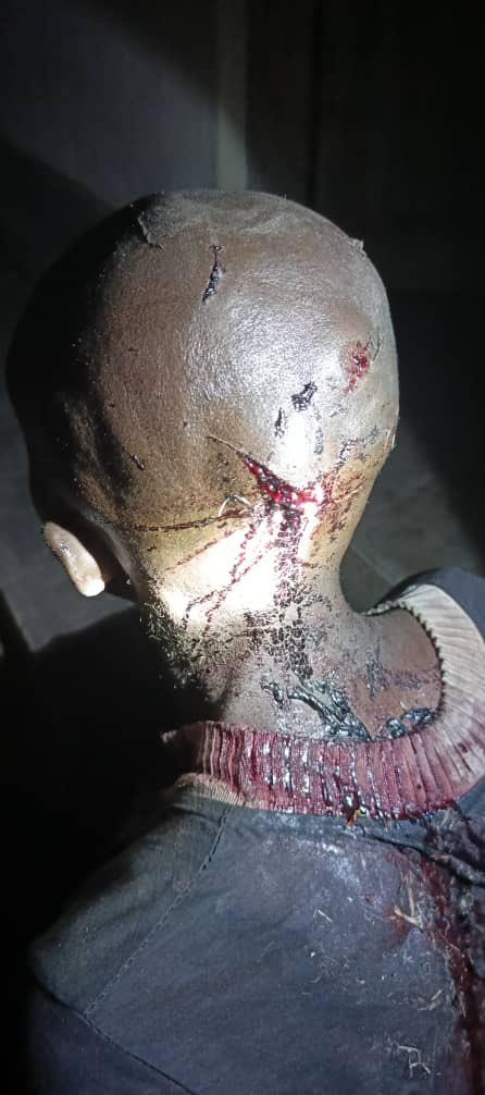 LawrenceKanyuka's tweet photo. MISE À JOUR SUR LA GUERRE IMPOSÉE PAR LE RÉGIME DE KINSHASA
1er SEPTEMBRE 2026

Le refus délibéré et persistant du régime de Kinshasa de neutraliser les FDLR constitue l’un des principaux facteurs d’aggravation de l’insécurité et de la détérioration continue de la situation sécuritaire, aussi bien sur les lignes de front que dans les zones civiles densément peuplées.

Dans la nuit du lundi 31 août 2026, vers 21h45, des éléments des FDLR ont mené une attaque contre des populations civiles dans la localité de Mulala, située à environ 20 km de Vitsumbi, dans le territoire de Rutshuru. Cette attaque a fait 4 morts et 10 blessés parmi les civils, tandis que 2 femmes ont été enlevées alors qu’elles travaillaient dans leurs champs.

L’AFC-M23 attire solennellement l’attention du peuple congolais et de la communauté internationale sur le déploiement systématique des FDLR par le régime de Kinshasa sur les différentes lignes de front, ainsi que sur les graves conséquences de leur présence en RDC, en particulier à proximité des populations civiles.

L’AFC-M23 réitère son engagement indéfectible à défendre et à protéger les populations civiles.