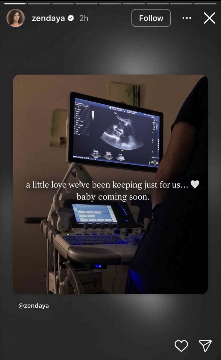 _pra__ise's tweet photo. This is truly unbelievable! A few days ago, Zendaya and Tom Holland were spotted at the airport boarding a plane, with Zendaya reportedly pregnant. She later posted on her Instagram Story that they're expecting their first baby soon.🥹❤️

Early this morning, Zendaya shared another picture of an ultrasound on her Instagram Story.

Wow! Congratulations to Zendaya and Tom Holland on this beautiful news!👶❤️🎉