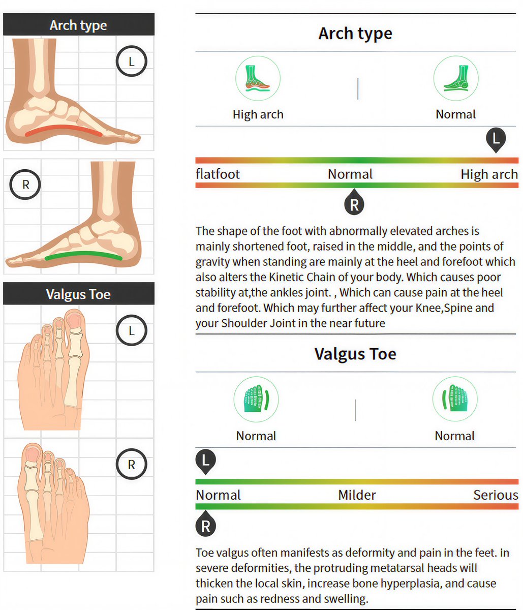 HarkenWong's tweet photo. Shoe retail isn't just about shelves — it's about showing customers what their feet actually look like.
A 3-second scan turns foot data into a clear profile. More trust, better fit, easier close.
Do your customers know their arch type? https://t.co/EUa0mPzJjL