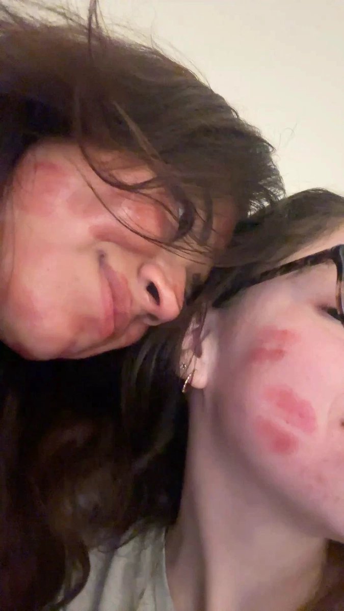 Nymph0MIA's tweet photo. @_URBXTCH is so soo soooo cutieeeeeee mwahhhhhhhhhhhhh 💋💋💋💋💋💋💋💋💋💋 https://t.co/a3mRrsKSzP