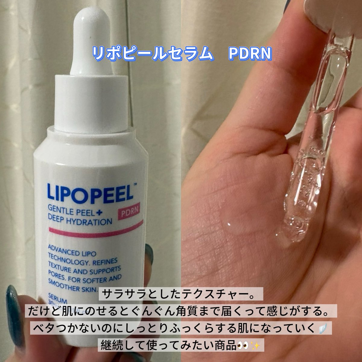 sui0112sui's tweet photo. ãPRãLIPOPEEL(ãªãããŒã«)ãããããªãããŒã«ã»ã©ã PDRNãšãªãããŒã«ãã¹ã¯PDRNãããã ããŸããð
奥ãããµã£ããããªã®ããèã«ãªãããã
ã©ã¡ããã¹ãŒãšèã®è§è³ªãŸã§æµžéãããŠããæããããŠæ°æã¡ãè¯ãð«§
PDRNãšã¯...ãµã±ç±æ¥ã®DNAã®æçã§äººã®DNAãšæ§é ãè¿ãæå
#LIPOPEEL https://t.co/E1gmf9G76X