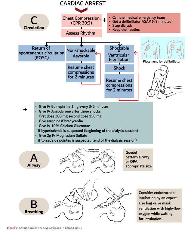 NDTsocial's tweet photo. Life support in hemodialysis emergencies—treatment standard

https://t.co/geIScvgHCZ https://t.co/mEpJRsOjd4
