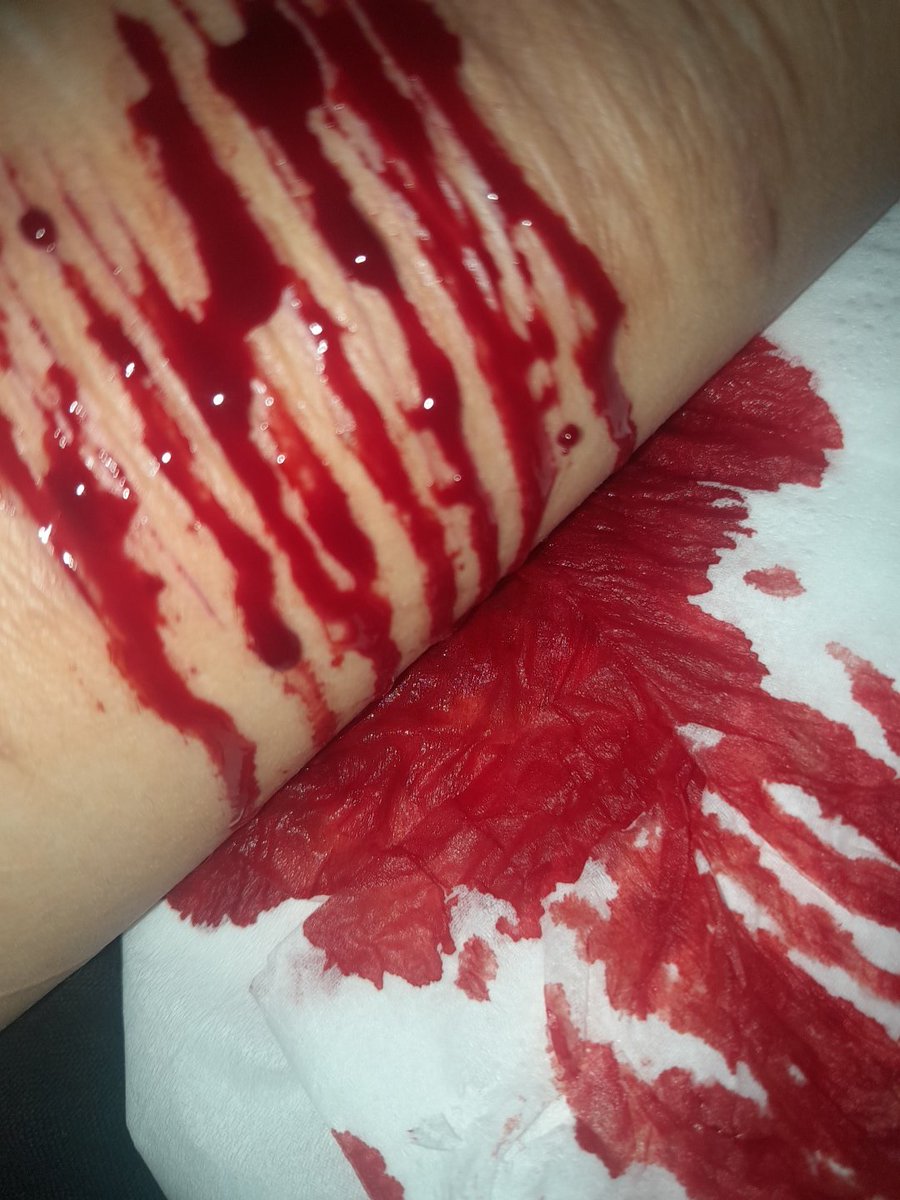 F1anry's tweet photo. oohh I felt the bloodflow coming out #shtwt #slitwt #selfharm https://t.co/DXsb6oQ2Wn