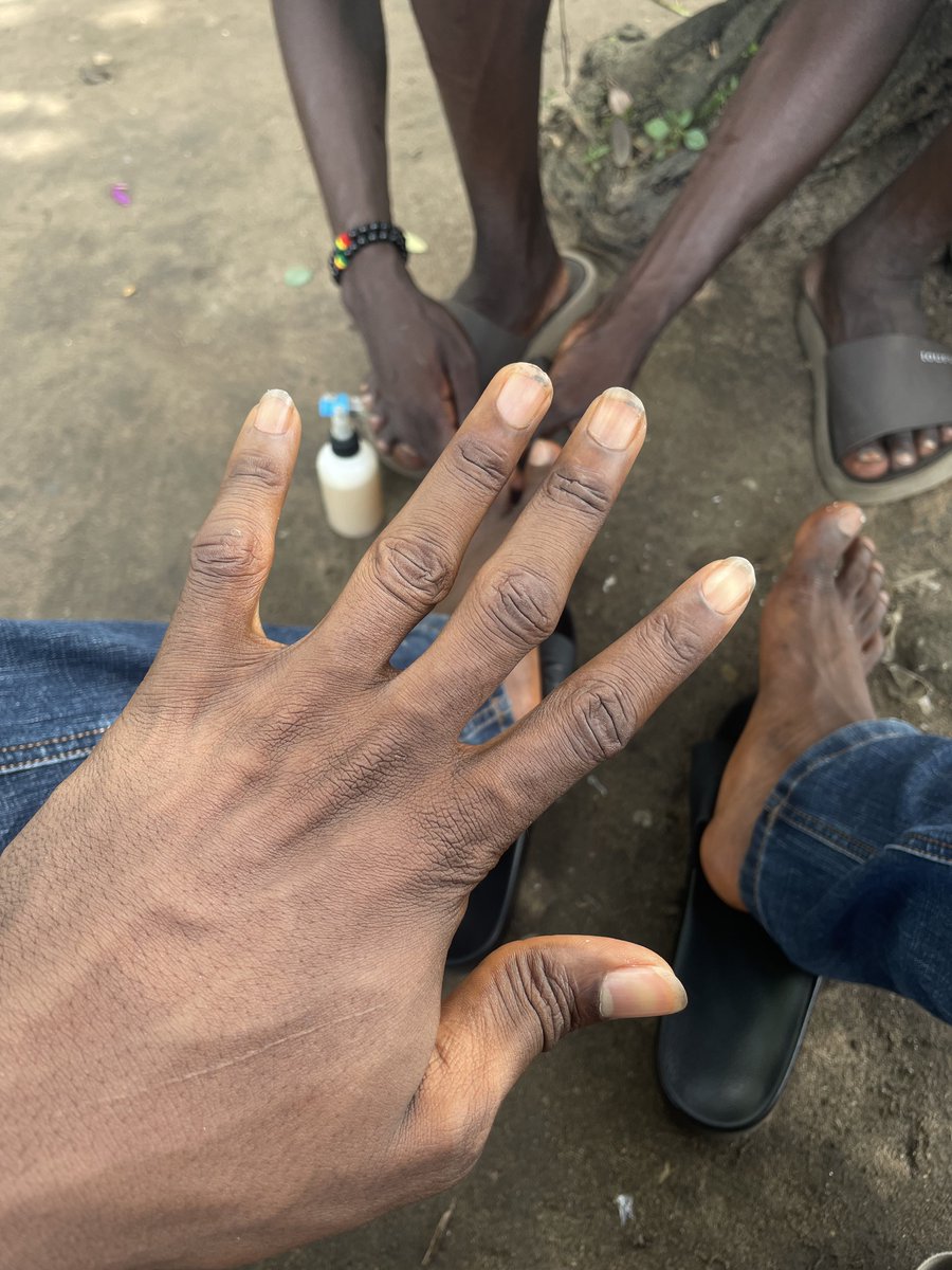 waggydey4you's tweet photo. Same thing wey Nail techs Dey charge 10k for, aboki Dey run am for 500 naira for this side…💔😂🙆🏾‍♂️ https://t.co/QY3yMMr9uO