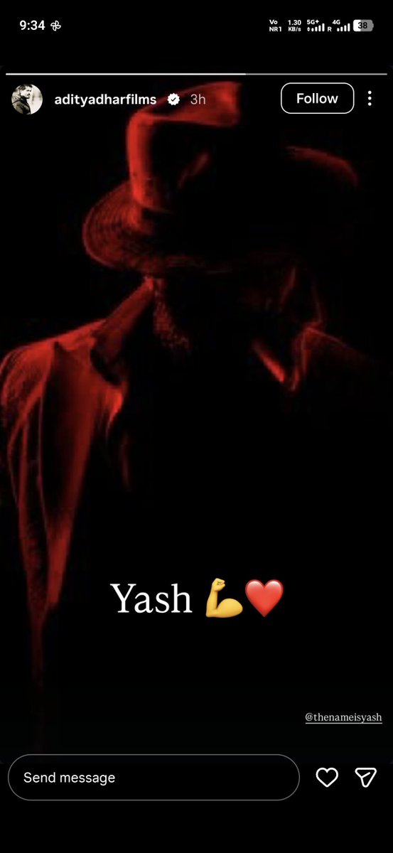 Chanchal0601201's tweet photo. @FilmiHindustani @RGVzoomin Maybe he is in coma https://t.co/6eIyIRY4ej