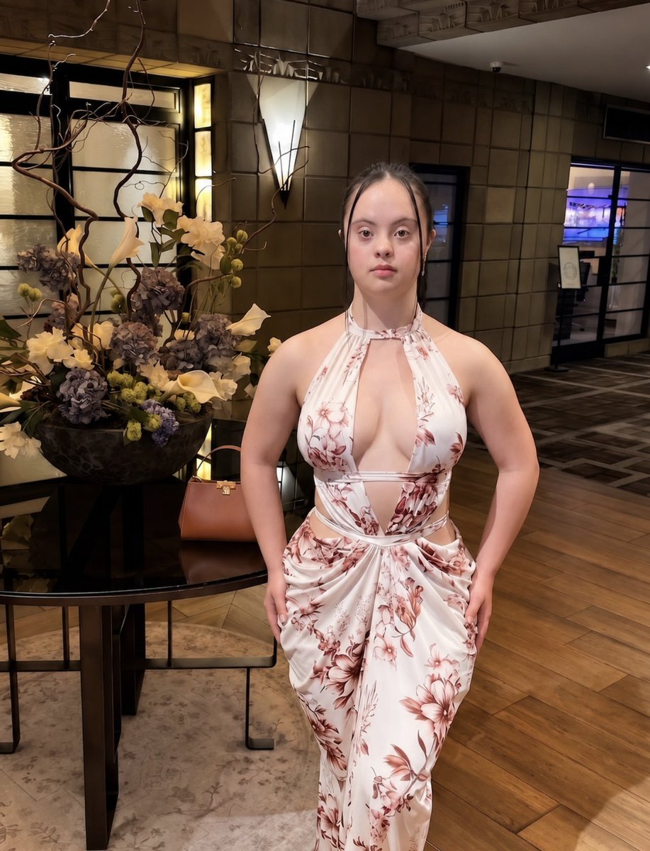 realnorma_kay's tweet photo. The world most Beautiful woman with Downs Syndrome https://t.co/UnRdHmbUgQ