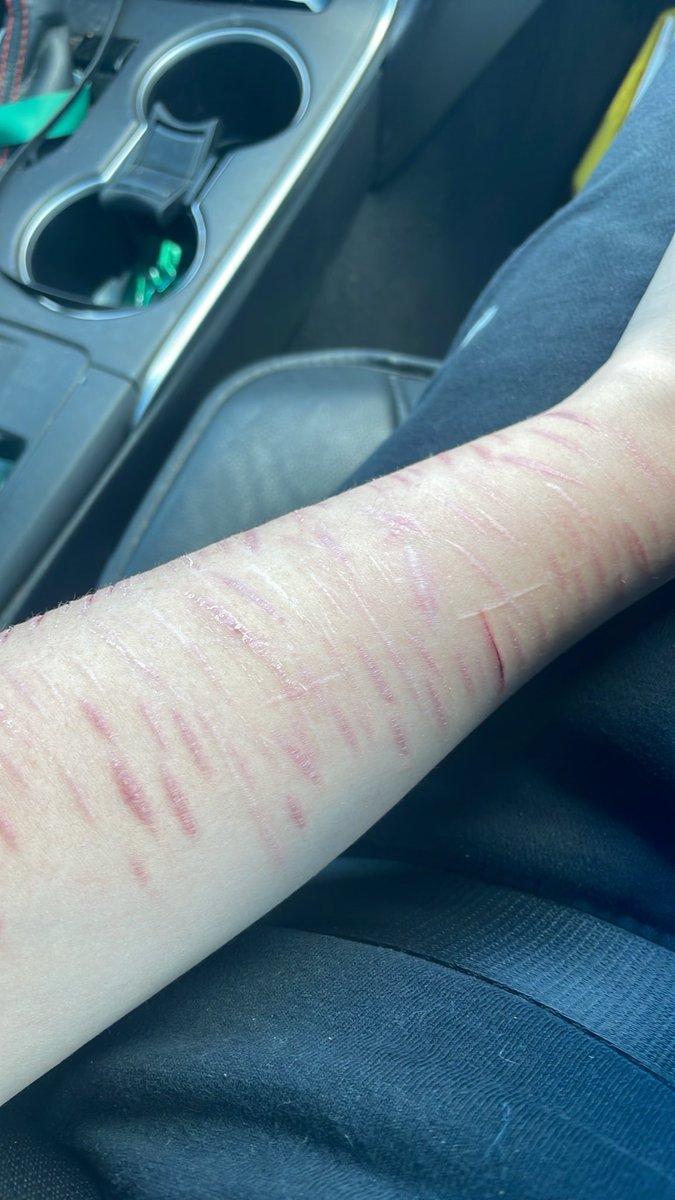 cuddlepuppyblu's tweet photo. I luv my arm :3 #shtwt #kms #ineedhead https://t.co/63kxmGkLaJ